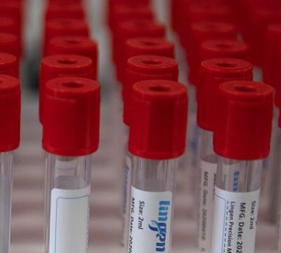 Hopes of HIV cure after breakthrough using gene-editing ‘scissors’