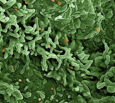 Mpox: strain 1b in focus to understand lethality