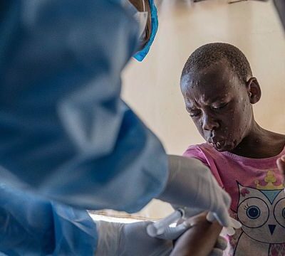 Mpox outbreak hits Kabare amid ongoing conflict in DRC