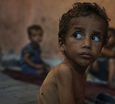 ‘From bad to worse’: Gaza hospital faces surge in child hunger deaths