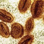 Mpox outbreak no longer a global health emergency, WHO chief says